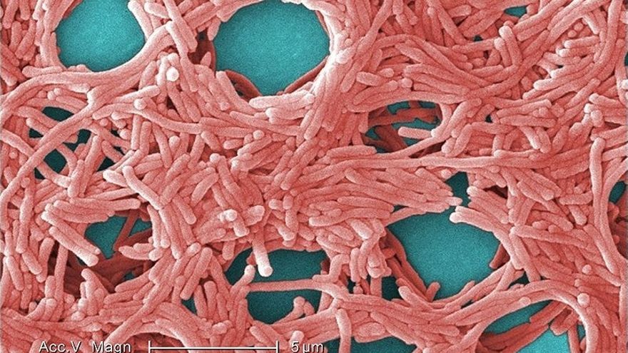 Imagen de bacterias de Legionella.