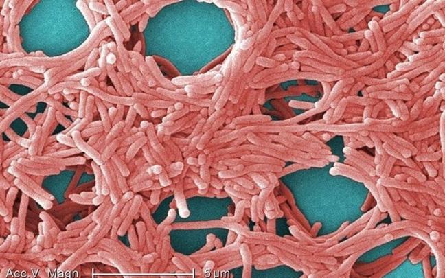 Imagen de bacterias de Legionella. Imagen de bacterias de Legionella.