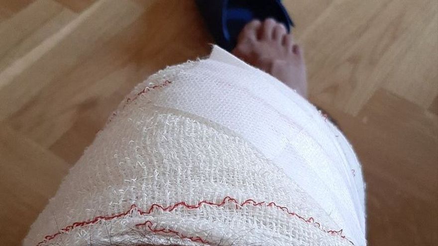 La rodilla vendada del tuitero tras pasar por el hospital.