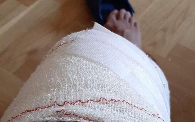 La rodilla vendada del tuitero tras pasar por el hospital. La rodilla vendada del tuitero tras pasar por el hospital.
