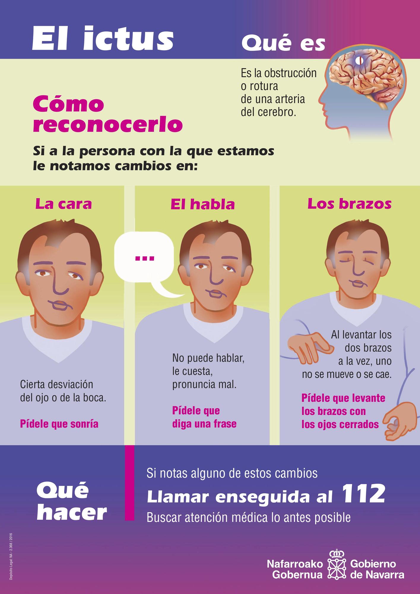 Cómo reconocer un ictus.