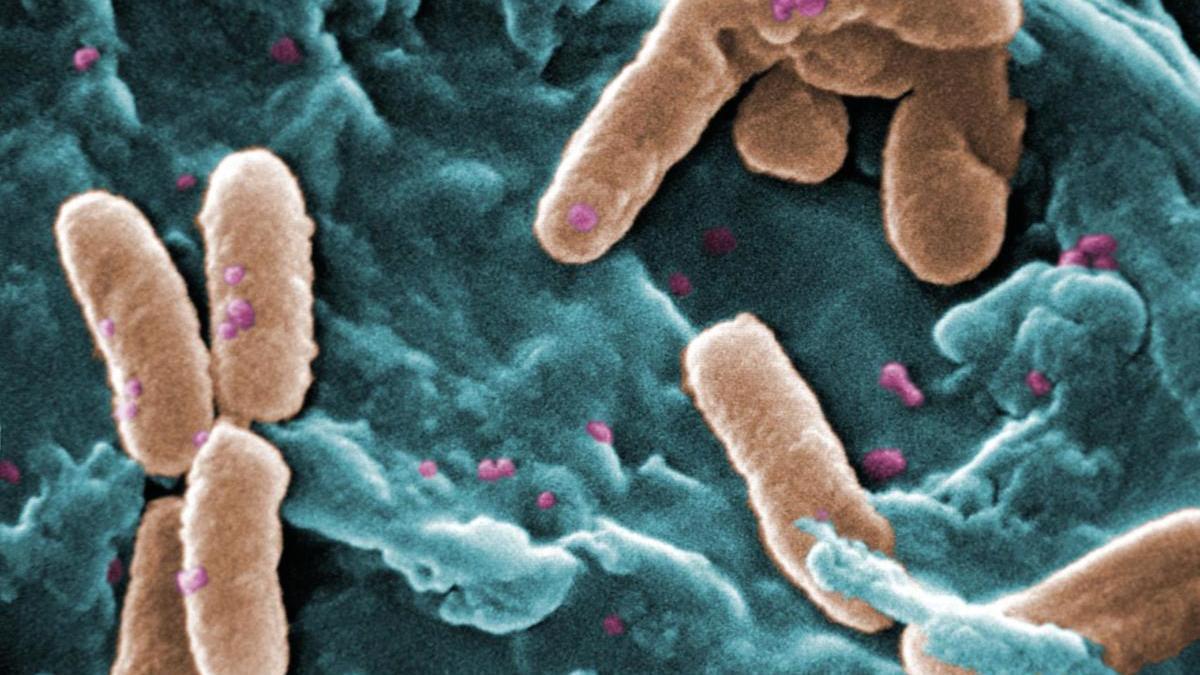 Pseudomonas bacterianas que causan neumonía en enfermos pulmonares.