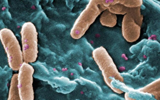 Pseudomonas bacterianas que causan neumonía en enfermos pulmonares. Pseudomonas bacterianas que causan neumonía en enfermos pulmonares.