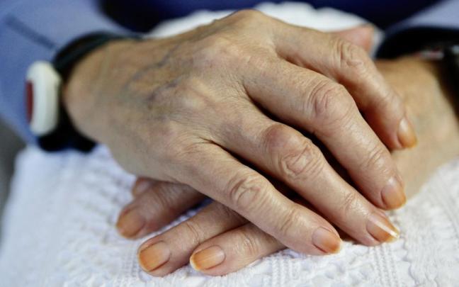 Los casos de Alzheimer crecen por el envejecimiento poblacional y aparecen perfiles más jóvenes. Los casos de Alzheimer crecen por el envejecimiento poblacional y aparecen perfiles más jóvenes.