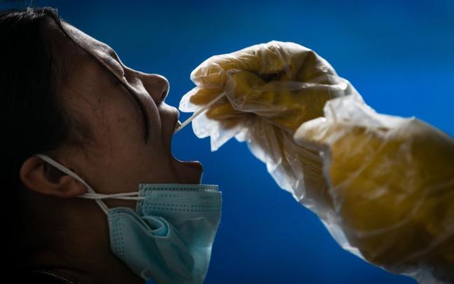 El virus fue detectado mediante muestras tomadas de la garganta de pacientes que habían tenido contacto reciente con animales. El virus fue detectado mediante muestras tomadas de la garganta de pacientes que habían tenido contacto reciente con animales.
