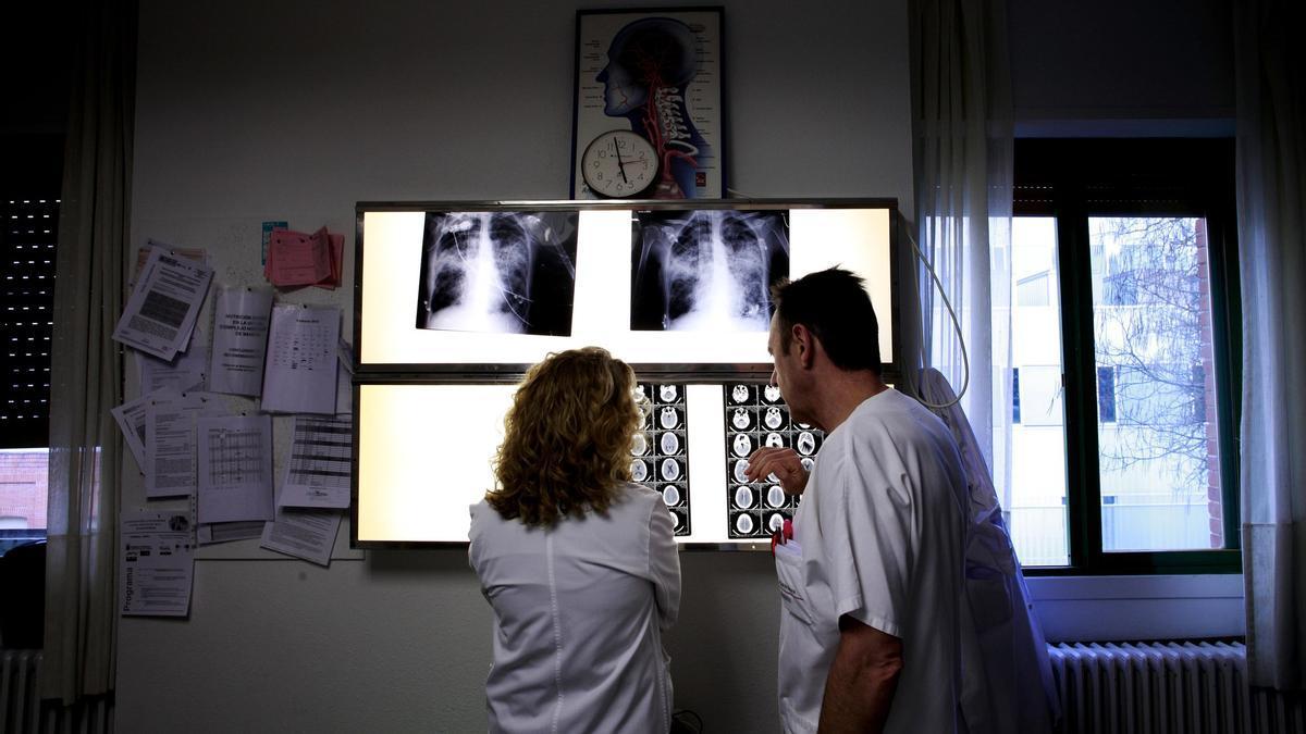 Dos médicos mirando radiografías y un TAC cerebral.