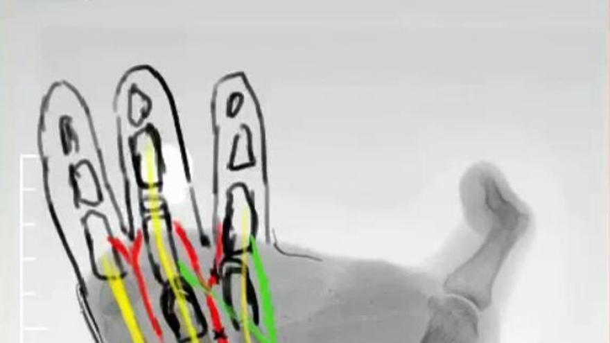 Reconstrucción virtual de la mano de Diego Albéniz