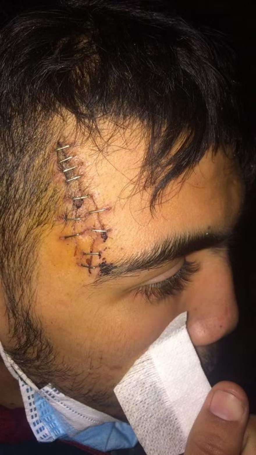 Lesiones causadas al primo del acusado.