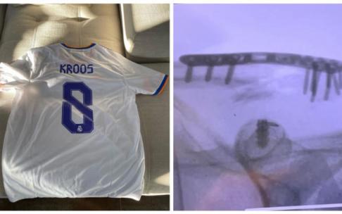 La camiseta de Kroos que le regaló su madre para suplir la rota en el accidente y la radiografía con los tornillos. La camiseta de Kroos que le regaló su madre para suplir la rota en el accidente y la radiografía con los tornillos.