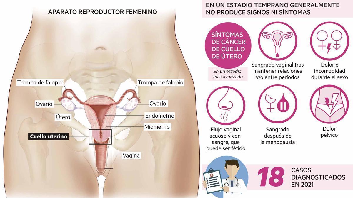 Gráfico sobre el cáncer de cérvix