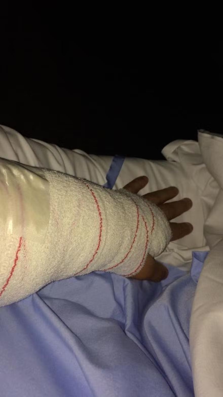 Brazo vendado que presentaba la víctima tras ser acuchillado.