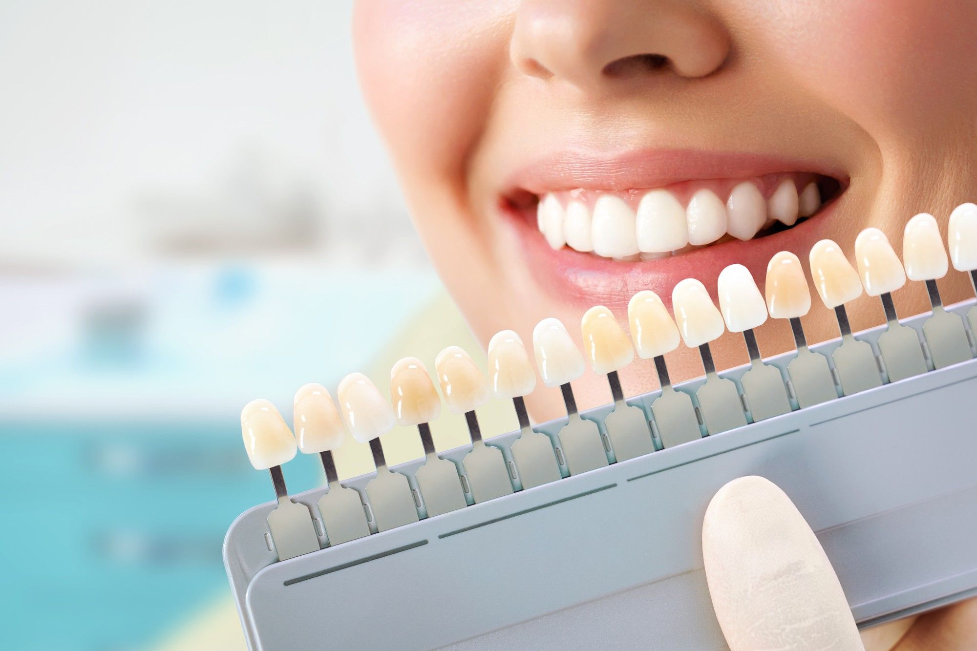 Muestrario de piezas dentales de distintas tonalidades.