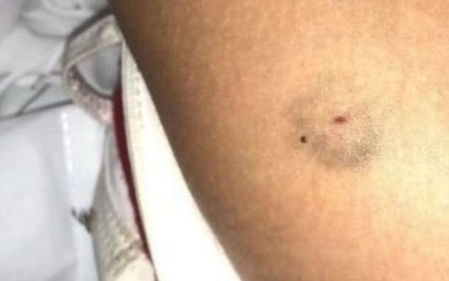 Imagen de archivo de un pinchazo por sumisi&oacute;n qu&iacute;mica