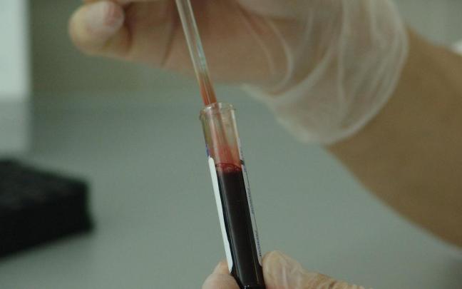 Un an&aacute;lisis de sangre.