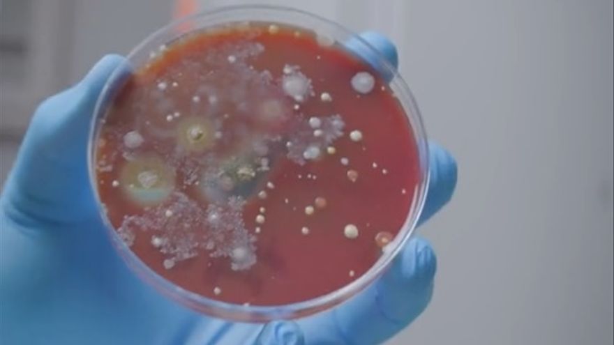Multitud de bacterias almacenadas en una Placa Petri.
