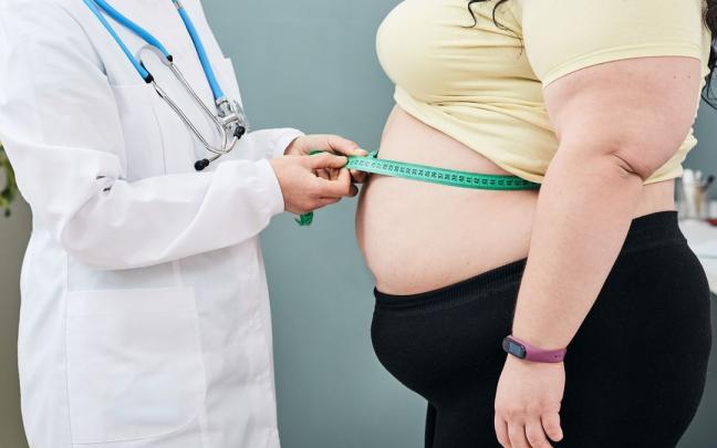 Paciente con obesidad. Paciente con obesidad.