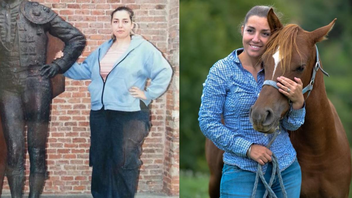 Aintzina Intxausti antes y después de operarse.