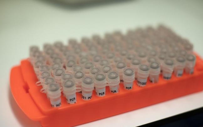 Imagen de unas pruebas covid