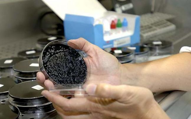 Realización de pruebas para determinar la existencia de Legionella