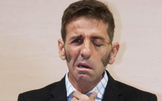 Padilla, en la rueda de prensa que ofreció cuando recibió el alta médica tras la cogida en Zaragoza.