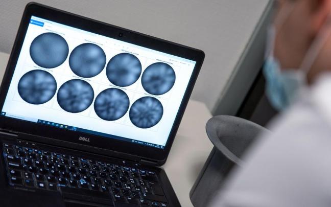 El cáncer de mama es el tumor más diagnosticado del mundo. El cáncer de mama es el tumor más diagnosticado del mundo.