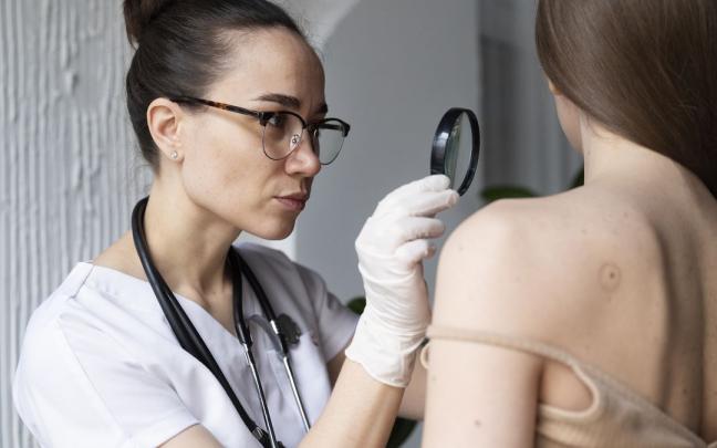 cáncer de piel / melanoma