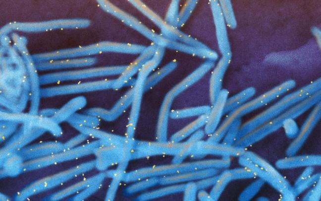 Imagen del virus respiratorio sincitial (coloreado en azul) obtenida por microscopía electrónica (NIAID). Imagen del virus respiratorio sincitial (coloreado en azul) obtenida por microscopía electrónica (NIAID).