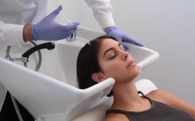La Mesoterapia capilar es una de las técnicas más utilizadas. La Mesoterapia capilar es una de las técnicas más utilizadas.