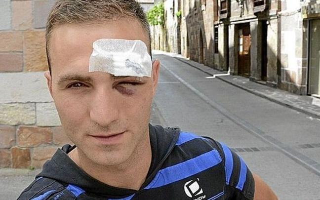 El remontista Eloy García Otxandorena, tras el pelotazo en Viana contra Zeberio II-Saldias.