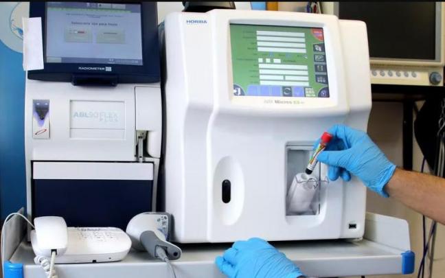 Dispositivo que permite analizar las muestras de orina y sangre en escasos minutos. Dispositivo que permite analizar las muestras de orina y sangre en escasos minutos.