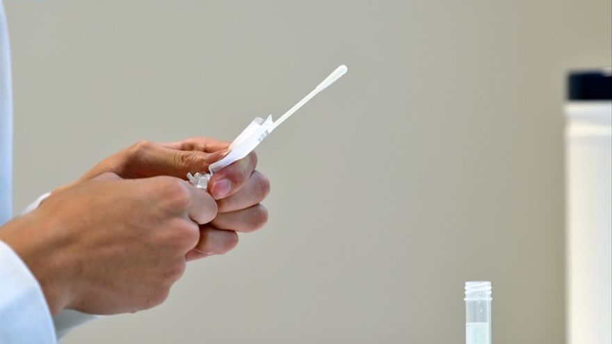 Prueba de RT-PCR para la infección por SARS-CoV-2.