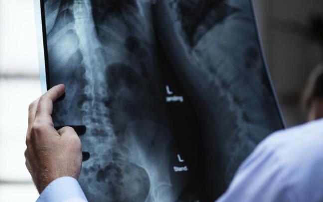 La fijaci&oacute;n del calcio en los huesos se consigue a base de ejercicio