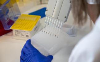 Una investigadora trabaja en un laboratorio de microbiología. Una investigadora trabaja en un laboratorio de microbiología.