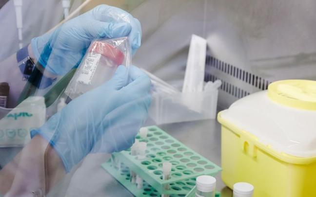 Una t&eacute;cnico de laboratorio sostiene una de las pruebas de an&aacute;lisis para la viruela del mono.