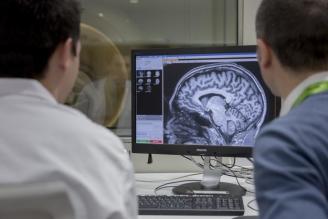 Mantener el cerebro activo puede retrasar la demencia de Alzheimer 5 años