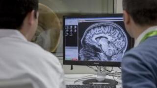 Mantener el cerebro activo puede retrasar la demencia de Alzheimer 5 años