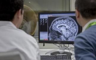Mantener el cerebro activo puede retrasar la demencia de Alzheimer 5 años