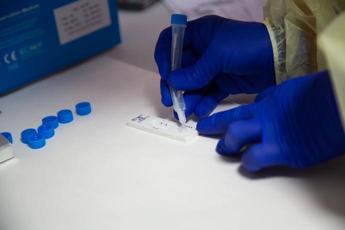 Sanidad retira del mercado un test de antígenos que daba resultados falsos positivos