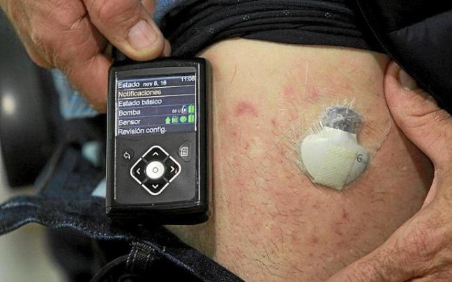 Un paciente diabético muestra la insulina y el sensor de medición, en la pierna. Foto: Oskar Montero Un paciente diabético muestra la insulina y el sensor de medición, en la pierna. Foto: Oskar Montero