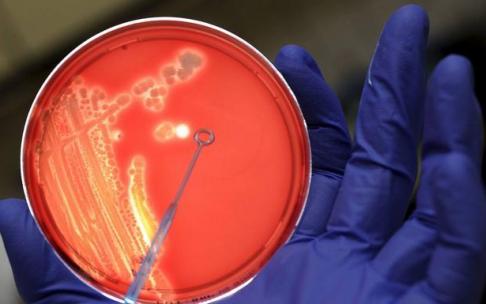 Un cultivo bacteriano. Un cultivo bacteriano.