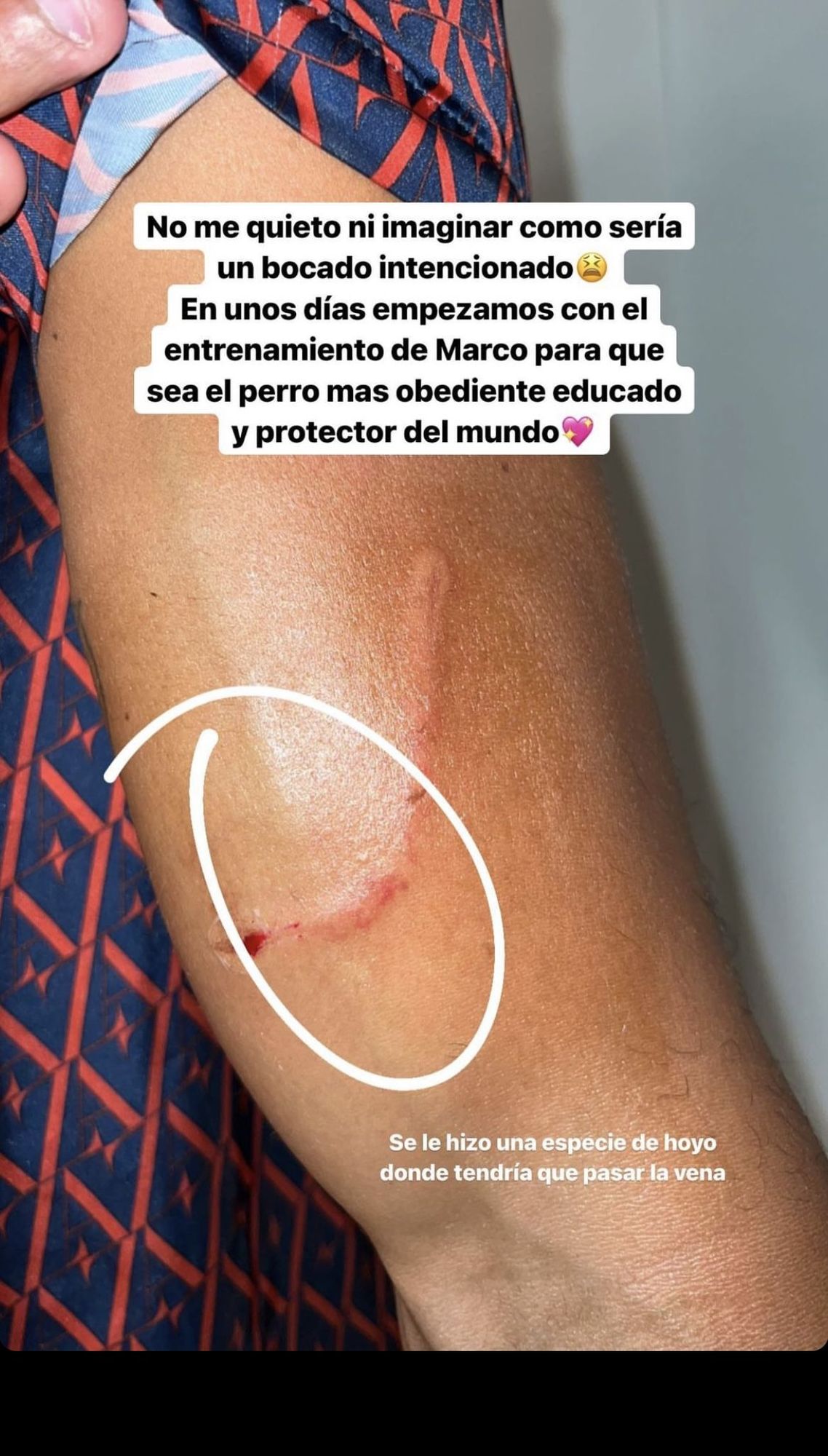 Sofía Suescun muestra las secuelas de Kiko Jiménez tras el incidente.