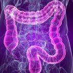 El estudio vincula la mala absorción de carbohidratos con el síndrome de intestino irritable.