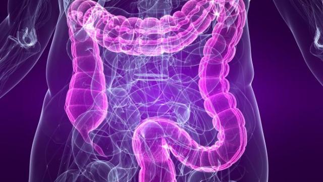 El estudio vincula la mala absorción de carbohidratos con el síndrome de intestino irritable. El estudio vincula la mala absorción de carbohidratos con el síndrome de intestino irritable.