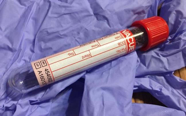 Un tubo con una muestra de sangre.