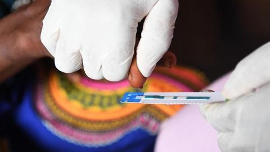 Prueba contra el VIH.