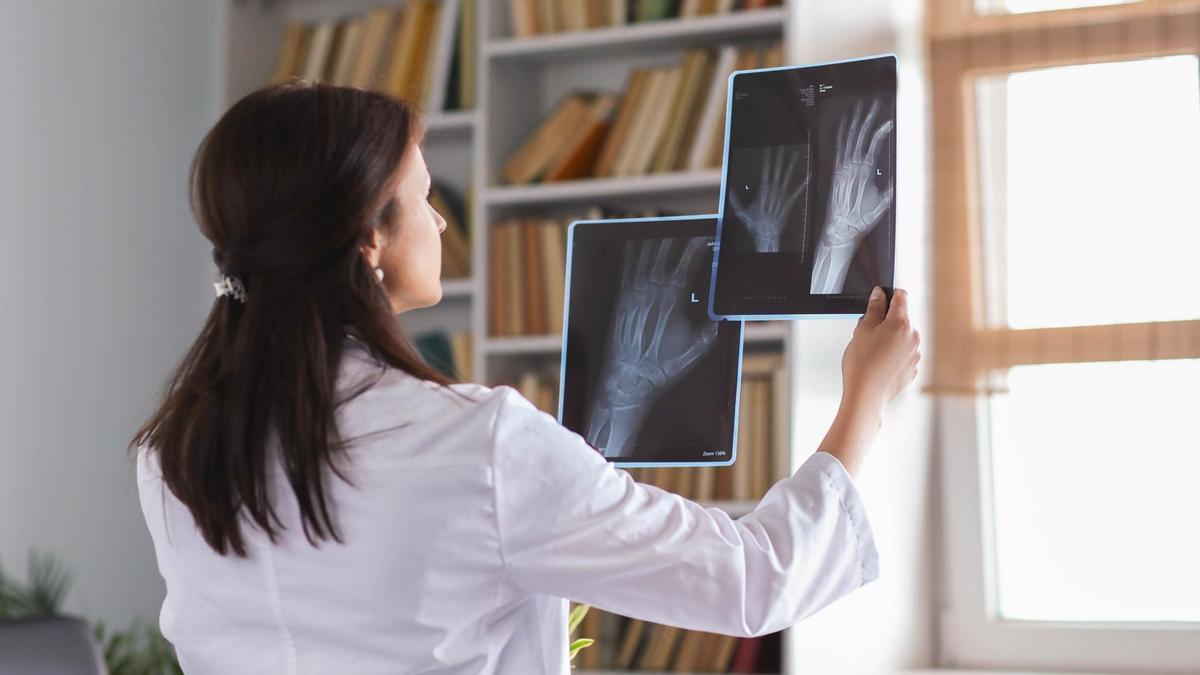 Una médico estudia varias radiografías de muñeca.