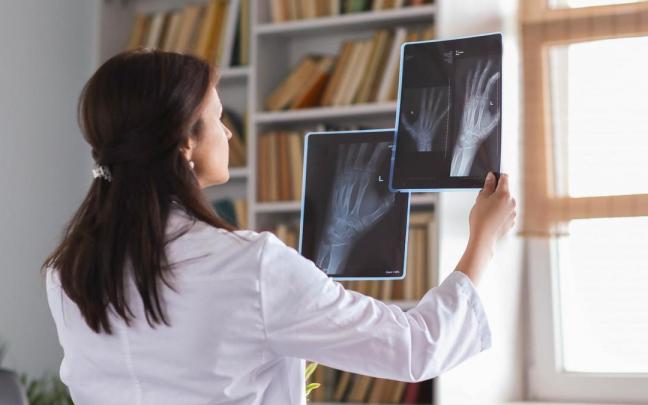 Una m&eacute;dico estudia varias radiograf&iacute;as de mu&ntilde;eca.