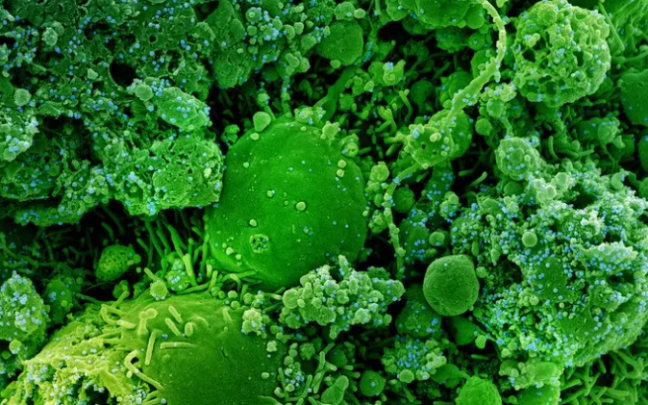 Micrografía electrónica de células infectadas con una cepa variante de partículas del virus SARS-CoV-2. Micrografía electrónica de células infectadas con una cepa variante de partículas del virus SARS-CoV-2.