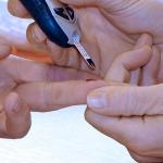 Control de diabetes