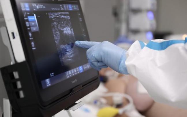 Un paciente es atendido en una Unidad de Cuidados Intensivos.